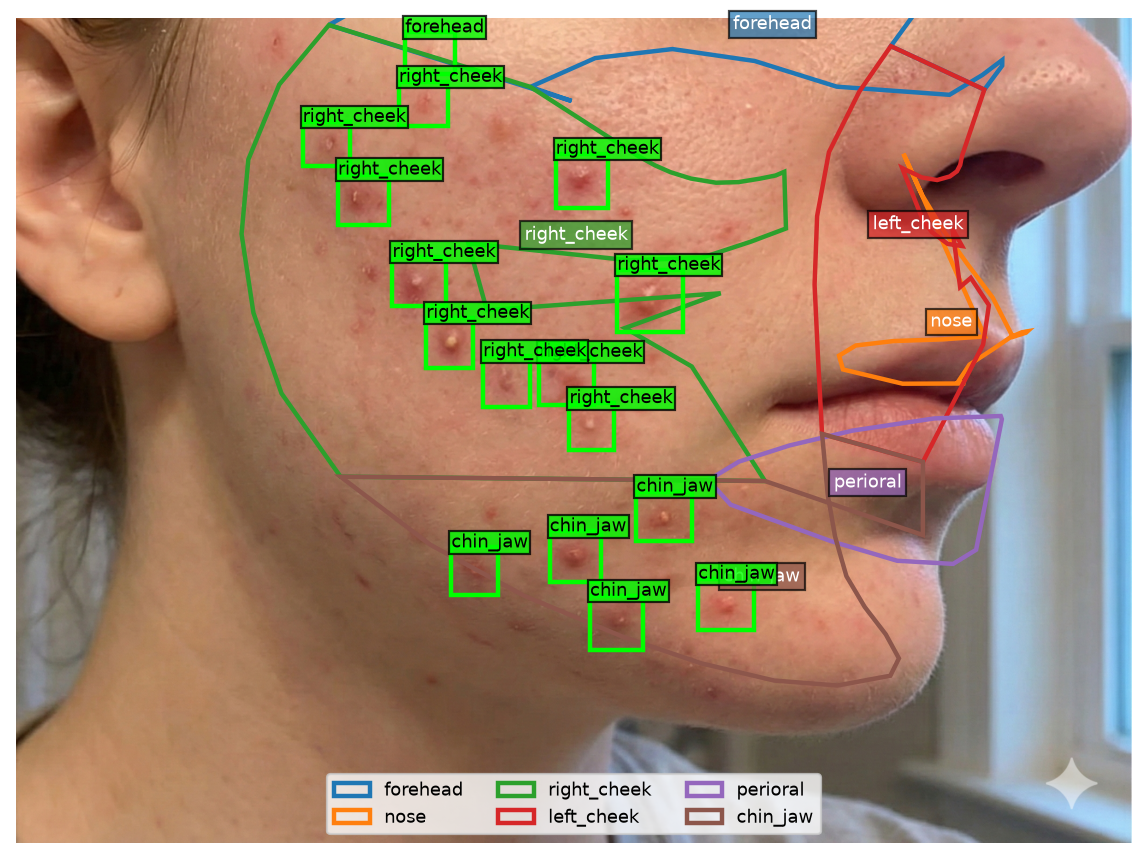 Face-region overlay used by the SkinScan analysis pipeline